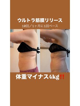 ビューティサロン ポノ(Pono)/ウルトラ筋膜リリース4キロ減!