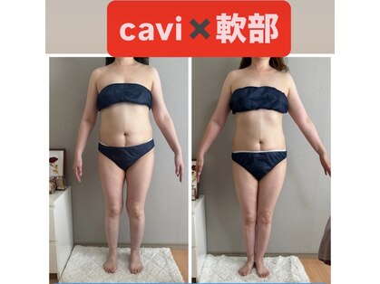 スズ(SUZU)の写真