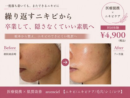 アルカンシエル(arcenciel)の写真