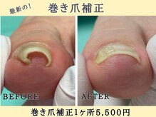 巻き爪補正店 名古屋駅前店