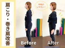 ゲンキ鍼灸整骨院(Genki鍼灸整骨院)/猫背改善