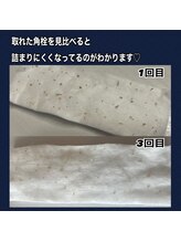 ソワン(soin)/SNSでも話題の究極の毛穴洗浄