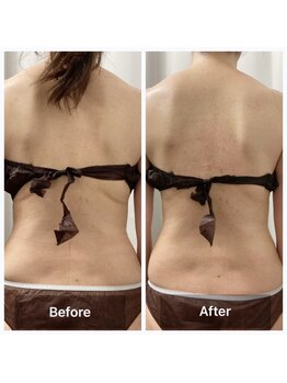 リアン(Lien)/before after