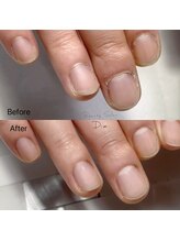 ディーア(Diae.)/