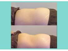 サロンビオーナ(SALON Biona)/腸もみ