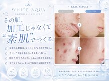 ホワイトアクア 柏店(WHITE AQUA)の雰囲気（ハーブピーリング/ララピールで様々な肌トラブルにアプローチ★）