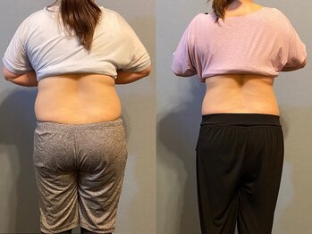 クリアリティ ボディ ケア(clearity body care)/2ヶ月間のビフォー＆アフター♪