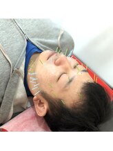 よつば鍼灸整骨院 春日院/美容鍼