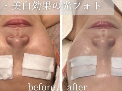 アイラブワン(eye love one)の写真