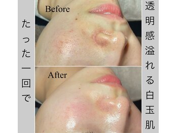 ブラックボックス(BLACK BOX)/日立市20代のお客様