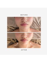 フィル 名駅店(fil)/リピートNo.1】fil 小顔コルギ