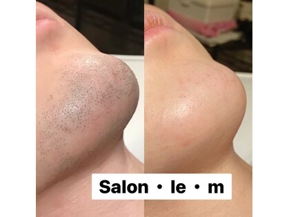 サロン ラ エム(Salon le m)の写真