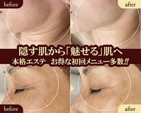 ヴィヴァン(Vivant)