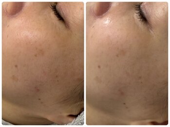 シェミー(CHEZ MEE)/シミしわ究極ケア*乾燥*保湿*潤