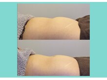 サロンビオーナ(SALON Biona)/腸もみ