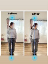 カラダリリース 浜松店/肩凝り初回施術比較