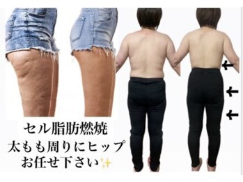 ヨサパーク マオ(YOSA PARK Mao)の写真/\下半身集中も当ダイエットサロンで/凝り固まって太くなった太もも・ヒップのお肉に集中アプローチ!