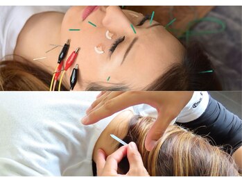 ワンドア(ONEDOOR)の写真/顔の悩みの原因は顔だけじゃない！？◆ほうれい線・たるみケア◆肩こりによる眼精疲労も一緒にスッキリ◎