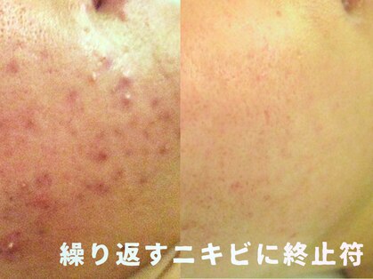 サロンドエステケイワイ(de KY)の写真