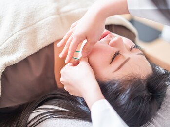 ヒナサロン(HINA SALON)の写真/【1日限定数名】完全プライベート空間◎一人ひとりのお悩みに合わせオーダーメイド全身鍼灸で根本改善★
