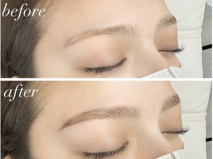 レビア(REVIA)の写真