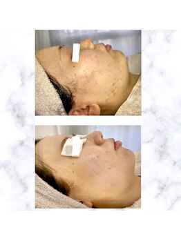 ルシェリア(Le cherien)/