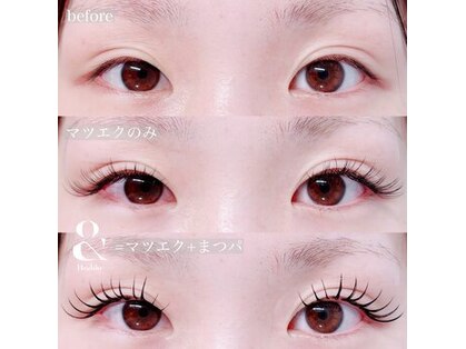 デイジー(Daisy)の写真