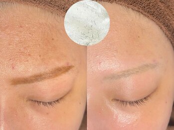 ルーナジェーナ(Luna llena)/池袋　エステ　ルーナジェーナ