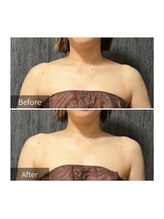 ヒヨリ(hiyori)/《before/after》body