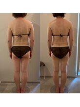 ラナ 京都西院店(Lana)/ガチガチの肩甲骨に