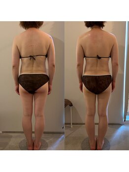 ラナ 京都西院店(Lana)/ガチガチの肩甲骨に