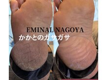 エミナル 名古屋栄店(EMINAL)の雰囲気（足裏のガサつきキレイになります♪）