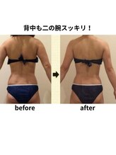 クリア(Clear)/背中も二の腕もスッキリ！