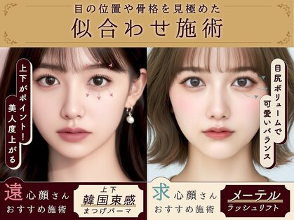 レティア アベノテン(Retia)の写真