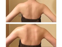 ヴィータローズディセ 名古屋本店(VITA ROSE Desse)/美しいバックラインをつくる