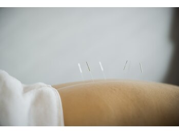 デルタエヌピー63+(δnp63+)/お客様施術例【小顔/薬院/福岡】