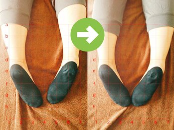 サプライズ整体院/30代ママの初回産後の骨盤矯正