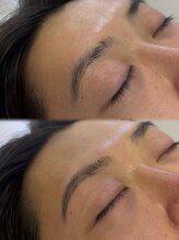 フィフティーンブラウジー 御茶ノ水店(15browsy)/ビフォーアフター