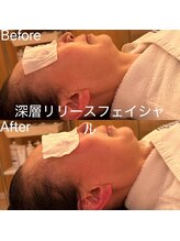 凪 横浜/美容成分を入れながら骨格調整