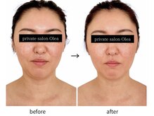オレア(Olea)の雰囲気（【施術内容】・Olea立体小顔矯正 1回　＋オプション　他）