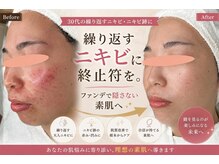 アロマ(AROMA)