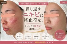 アロマ(AROMA)