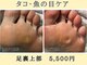 巻き爪補正店 名古屋駅前店【巻き爪・角質・たこ・魚の目】【10月1日OPEN(予定)】の写真