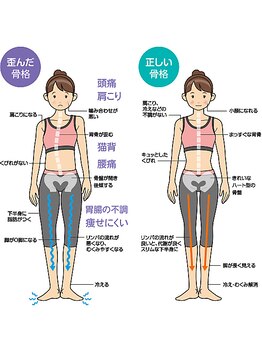 さにに(322)/骨盤の歪み