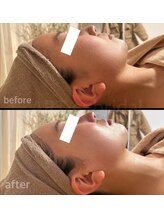 アルテ(ART-e)/Before/Afterプレ花嫁様1day