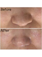 カシェボーテ(CACHE BEAUTE)/