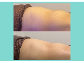 サロンビオーナ(SALON Biona)/腸もみ