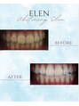 エレン 高槻店(ELEN)&nbsp;セルフホワイトニング/大阪/高槻/茨木/小顔/美白