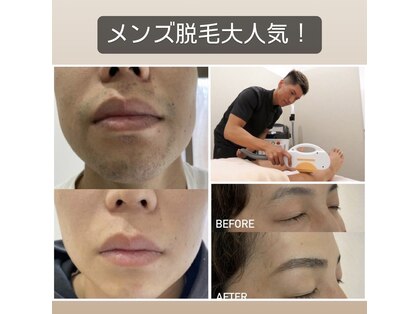 グランツ(GLANZ)の写真