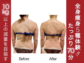 ニコワ(Nicowa)の写真/-10kg目指す！本気の大幅減量【全身痩身マシン5種類を一度に体験★70分￥7700】結果出しに自信あり◎